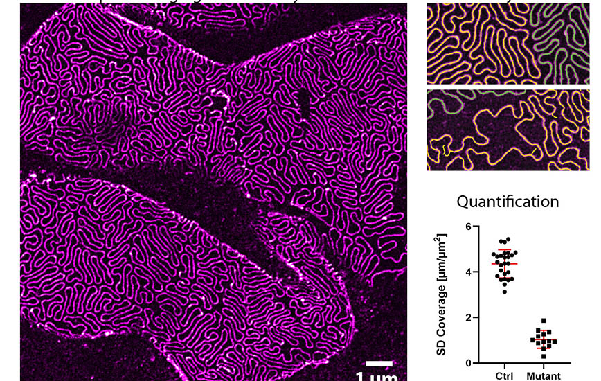 Njurens filterstrukturer avbildade genom 3D-mikroskopi