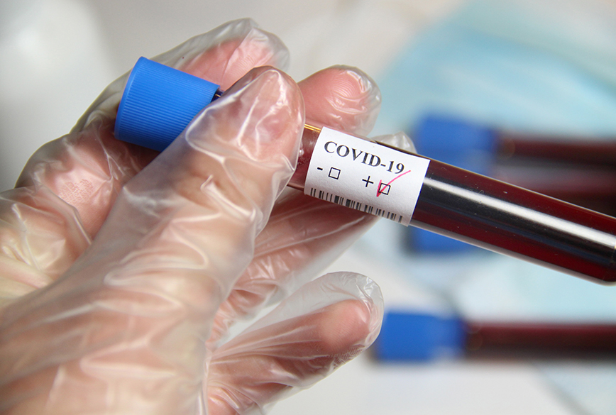 En sjuksköterskas hand i handske som håller ett blodprov som visar positivt covid-19-test.