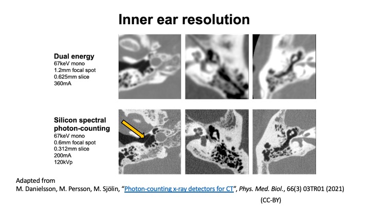 Picture of inner ear resolution