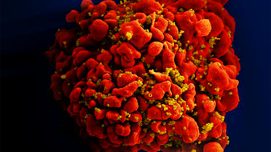Senapsfärgade viruspartiklar på en cells ytmembran.