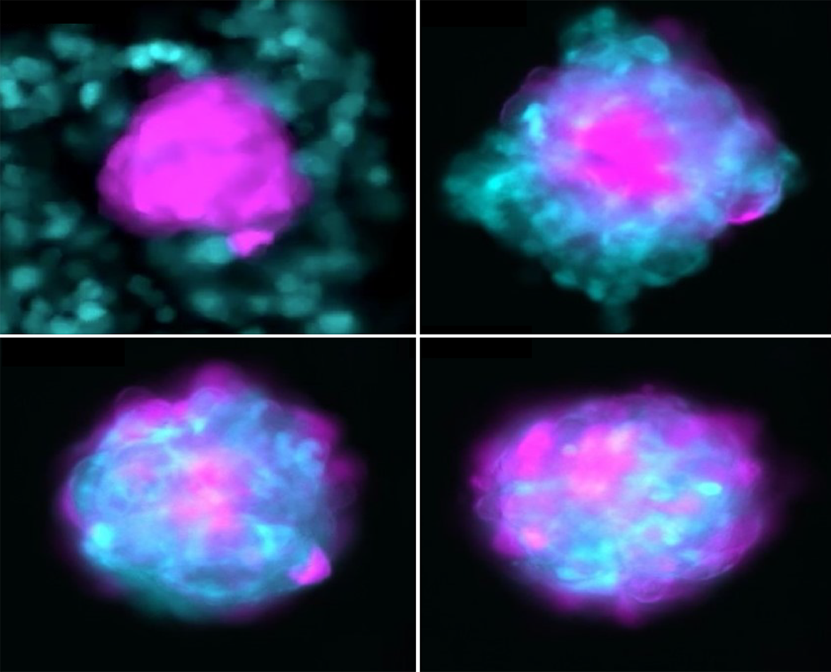 Viklund Group – Microscale Acoustofluidics