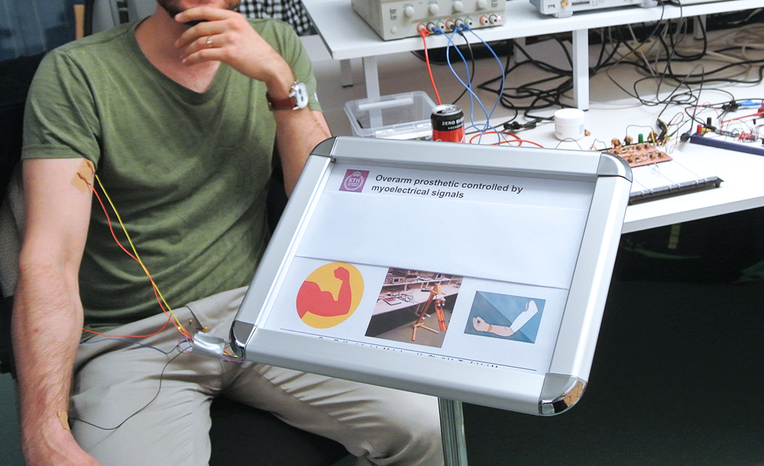 Elektroder är fästa i en students arm. Studenten demonstrerar sitt projektarbete, en armprotes som reagerar på hans arms rörelser.